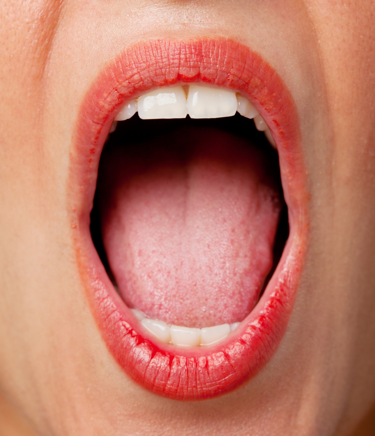  The Risks and Rewards of Cutting off Swollen Taste Buds