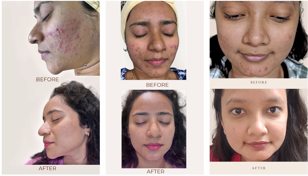  Discover the Best Skin Specialist at The Skin Firm - Top Skin Clinic in Wanowrie Pune