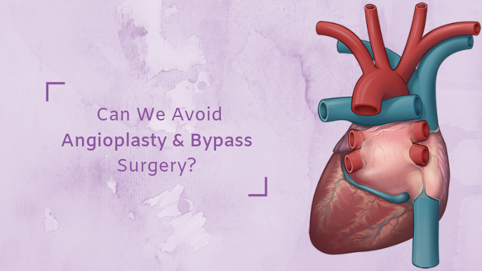  How to avoid bypass Angioplasty treatment