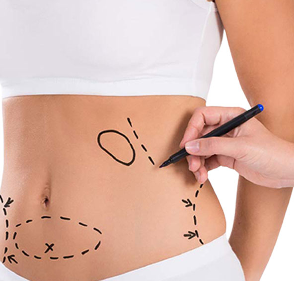  "Trim Your Waistline with Our Expert Tummy Tuck Surgery in Jaipur!"
