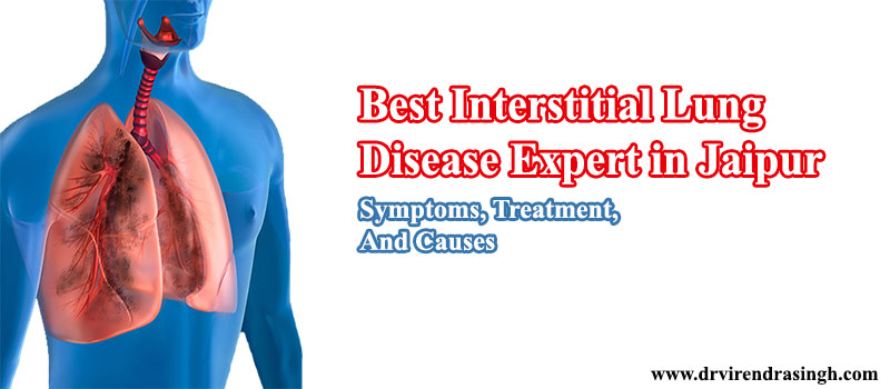  Best Lung Infections Treatment Doctors In Jaipur - Dr. Virendra Singh