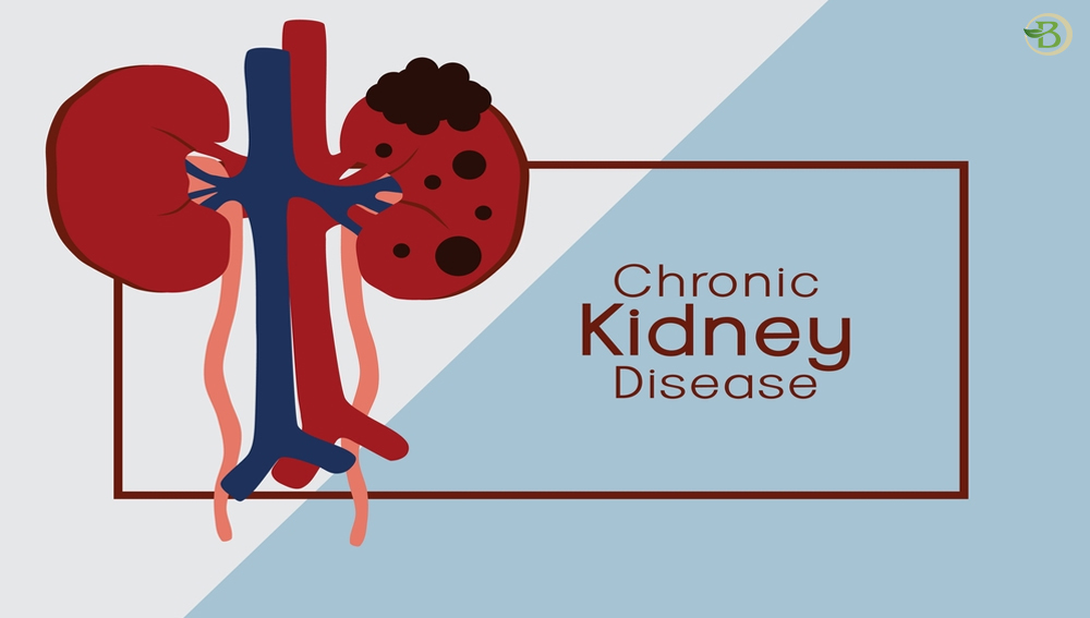  Holistic Methods for Maintaining Kidney Health: Going Beyond Dialysis and Traditional Therapies