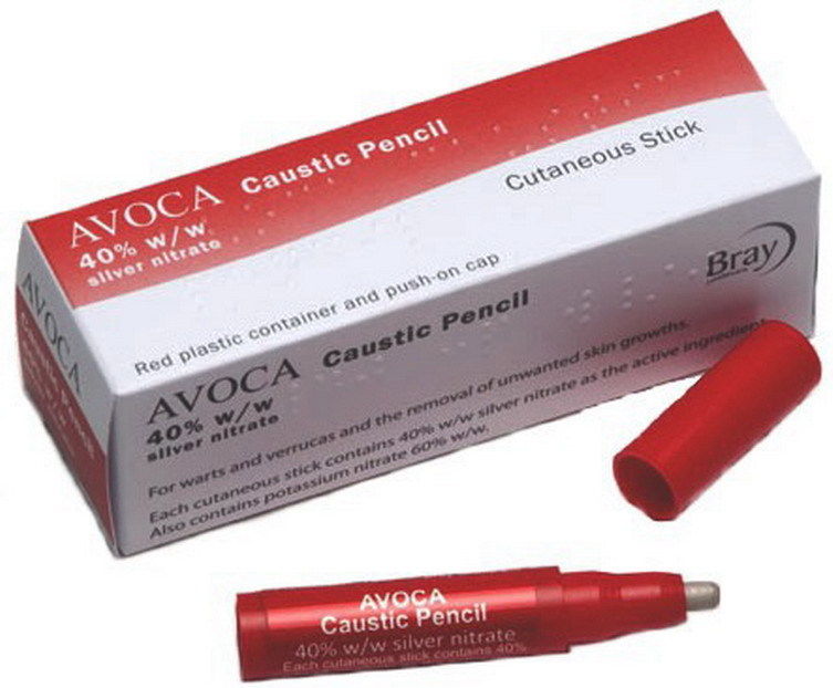  Avoca Caustic Pencil (40% w/w Silver Nitrate) - Wart & Verruca Treatment
