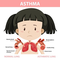  Asthma Specialist in Rajasthan: Dr. Sheetu Singh