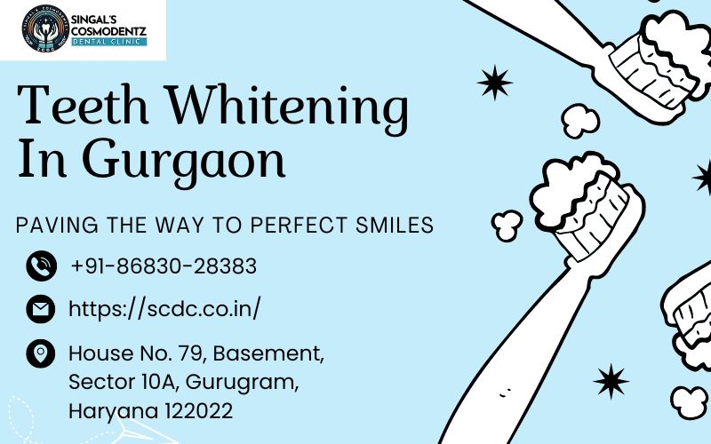  Expert Teeth Whitening in Gurgaon | Dr. Ishant Singal